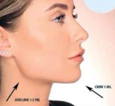 after11-1024x768-386x290